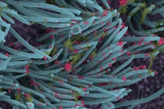 coronavirus