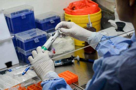 COVID, coronavirus
