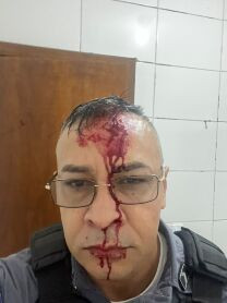 Policial ferido