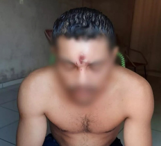 Tiro na cabeça 