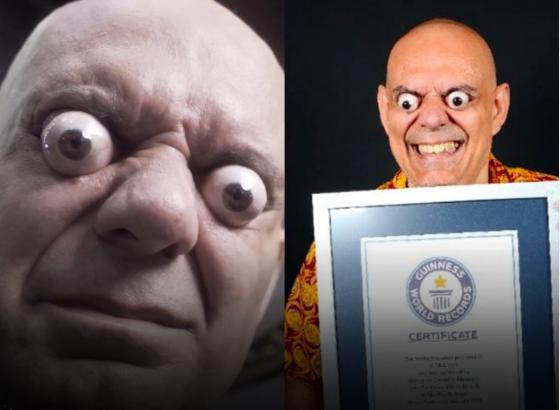 Brasileiro com o olho mais esbugalhado do mundo