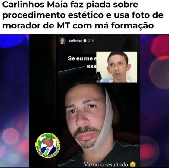 Carlinhos Maia faz piada com homem que tem rosto deformado