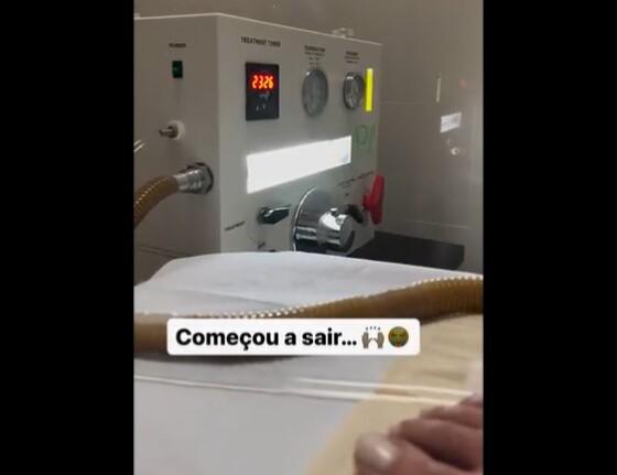 Cocô velho do ânus saindo de famosa