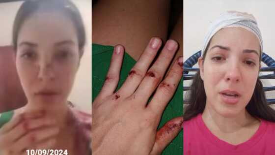 violência contra mulher 