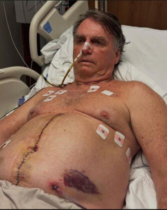 Bolsonaro no hospital