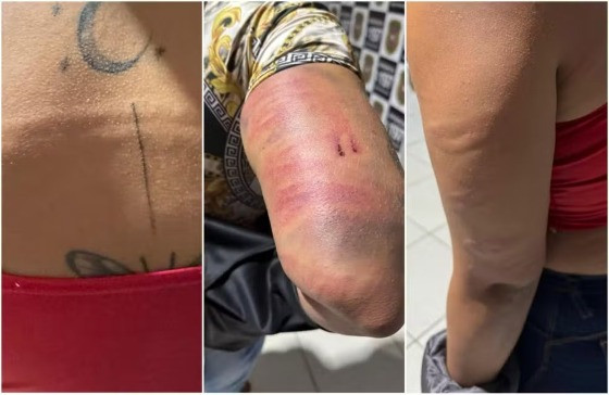 Vítimas de agressão de integrantes de facção