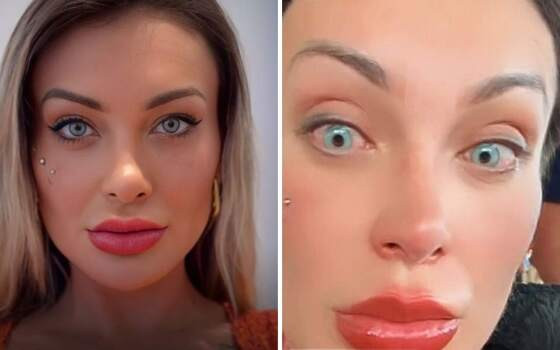 Andressa Urach