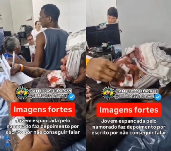 Mulher agredida pelo namorado 